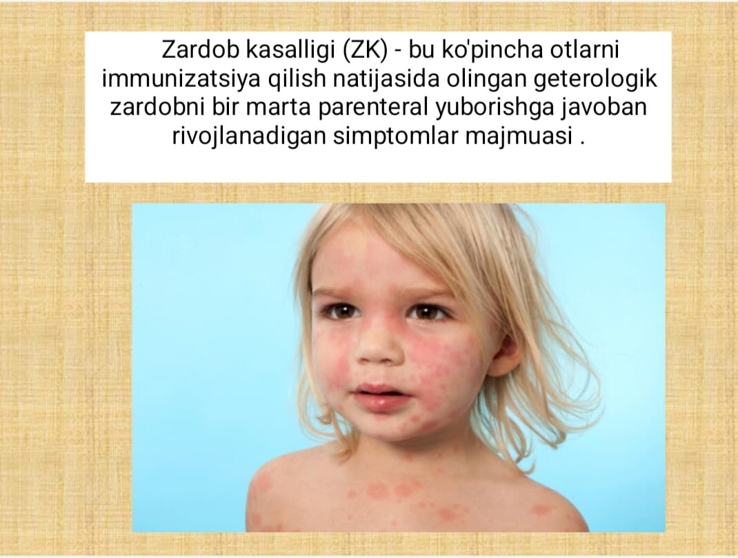 Zardob kasalligi