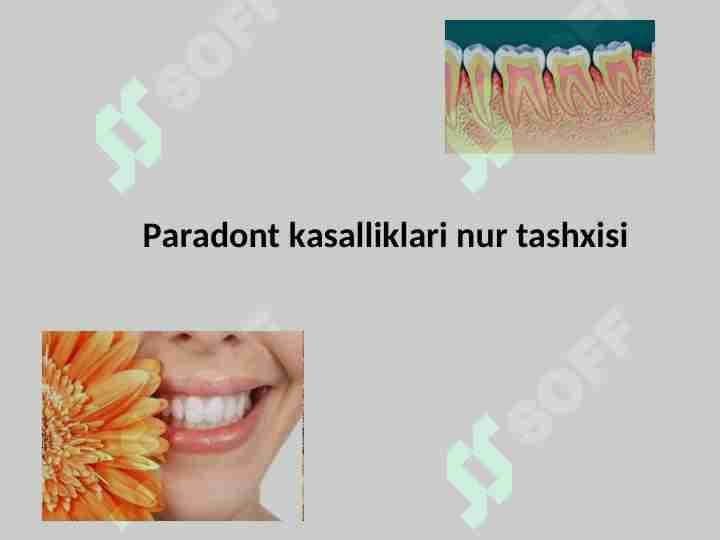 Paradont kasalliklari nur tashxisi