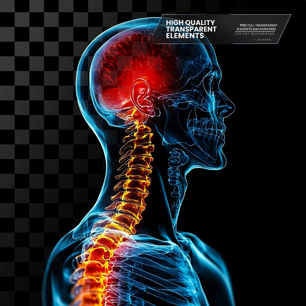 Ajratilgan joylar shaffof bo'yin og'rig'ini ko'rsatadigan grafik rentgen | Graphic xray showing neck pain with highlighted areas transparent