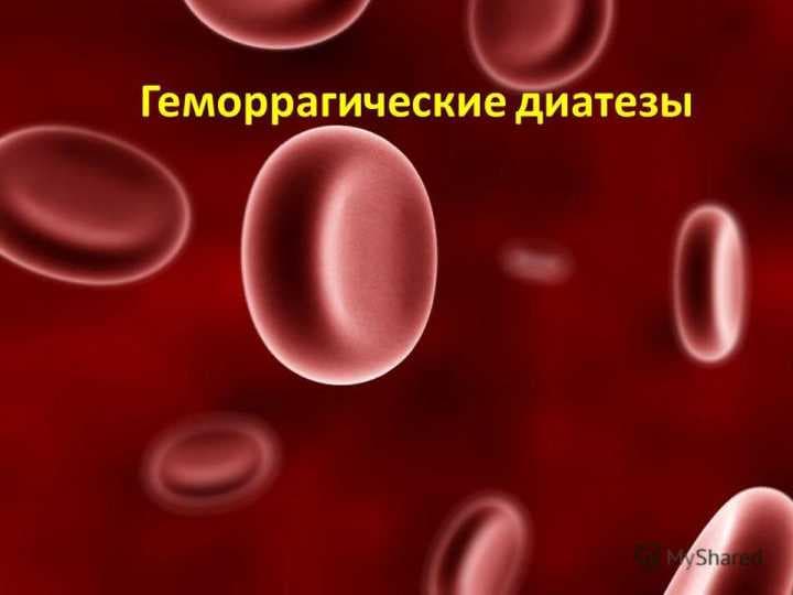 Gemorragik deatez (rus) ppt