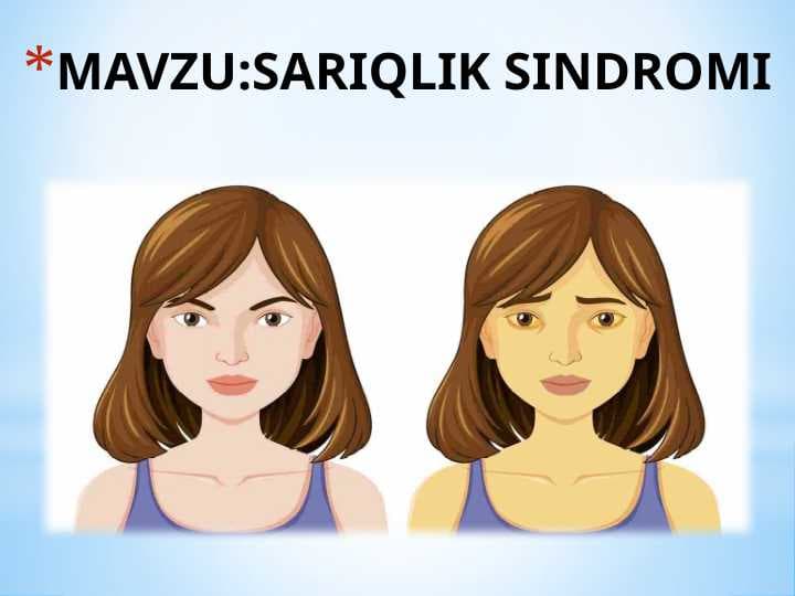 Sariqlik sindromi