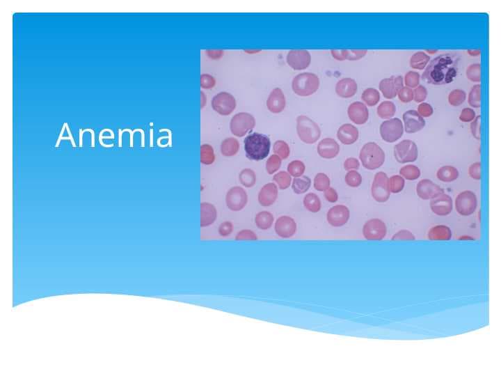 Anemia  Anemia is a laboratory diagnosis