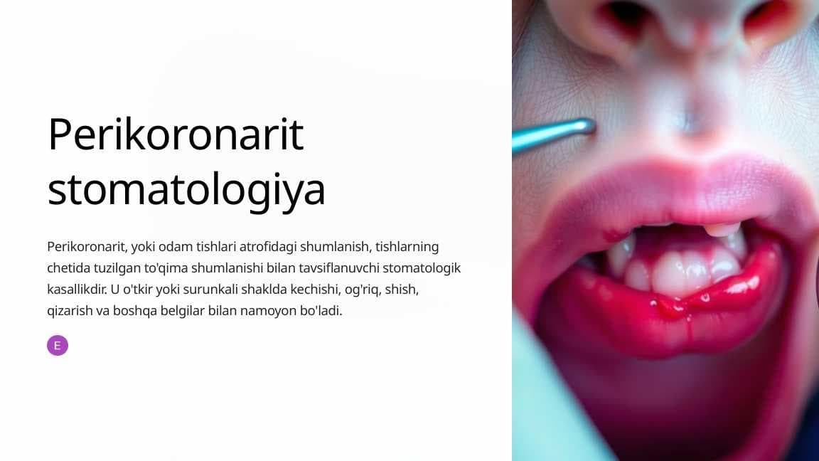 Perikoronarit stomatologiya