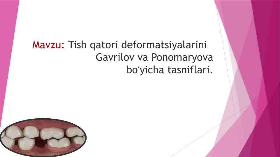 Tish qatori deformatsiyalarini   Gavrilov va Ponomaryova boʻyicha tasniflari