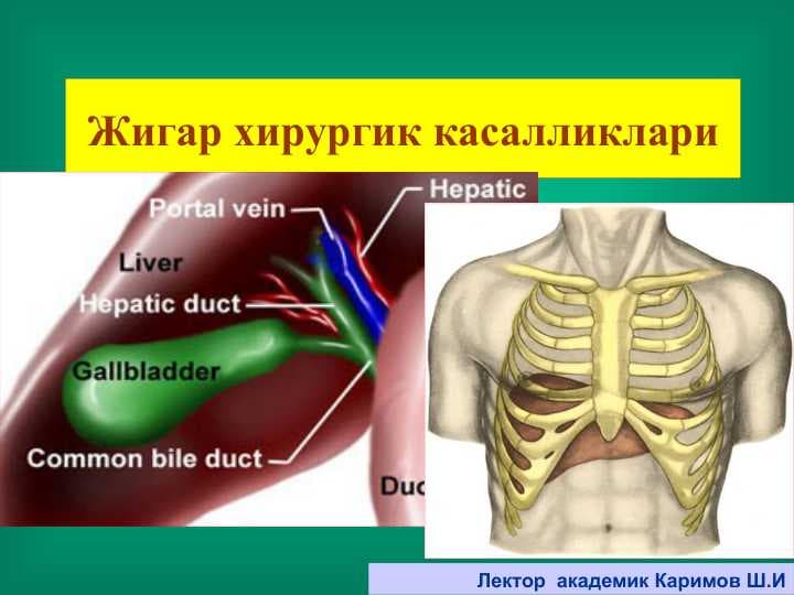 Жигар хирургик касалликлари