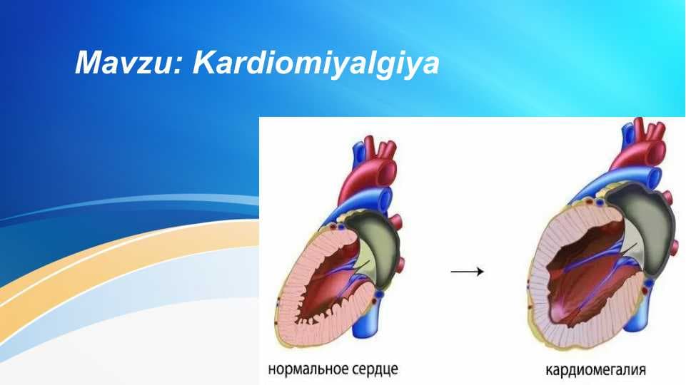 Kardiomegaliya