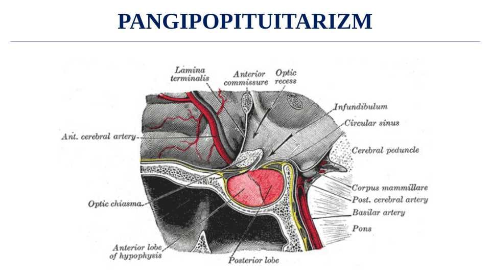 PANGIPOPITUITARIZM