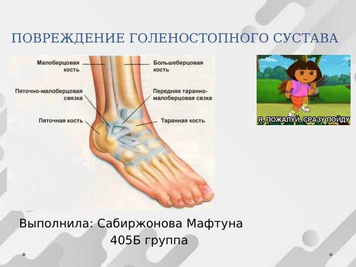 ПОВРЕЖДЕНИЕ ГОЛЕНОСТОПНОГО СУСТАВА
