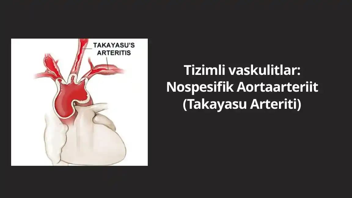 Takayasu Arteritining Etiologiyasi va Patogenezi