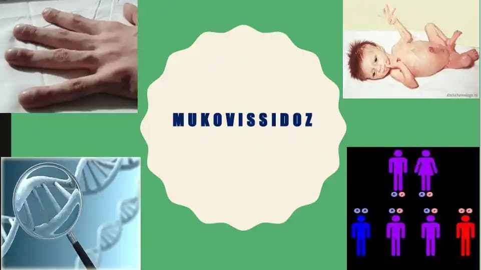mukovissidoz