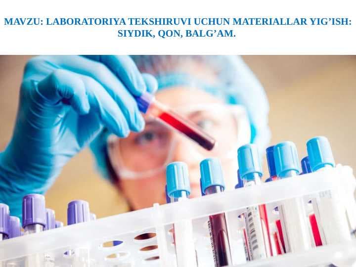 LABORATORIYA TEKSHIRUVI UCHUN MATERIALLAR YIG’ISH: SIYDIK, QON, BALG’AM.