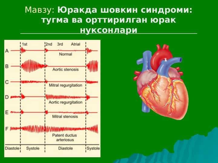 Yurakda shovqin sindromi: tug'ma va ortirilgan yurak nuqsonlari