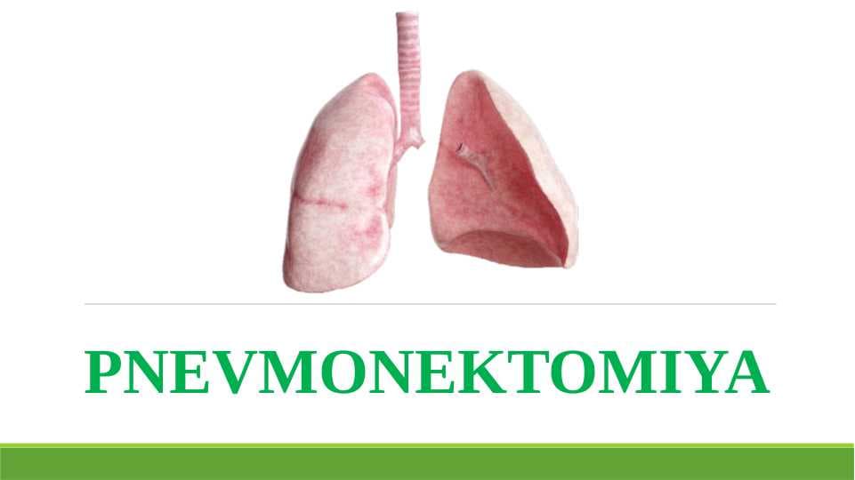 Pnevmonektomiya