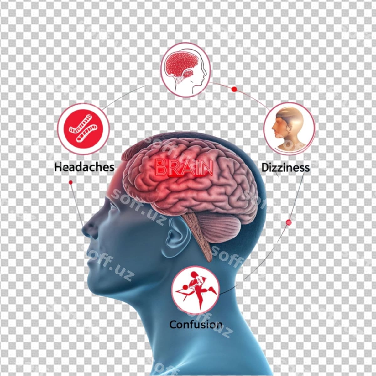 Inson miyasi anatomiyasi | Human brain anatomy