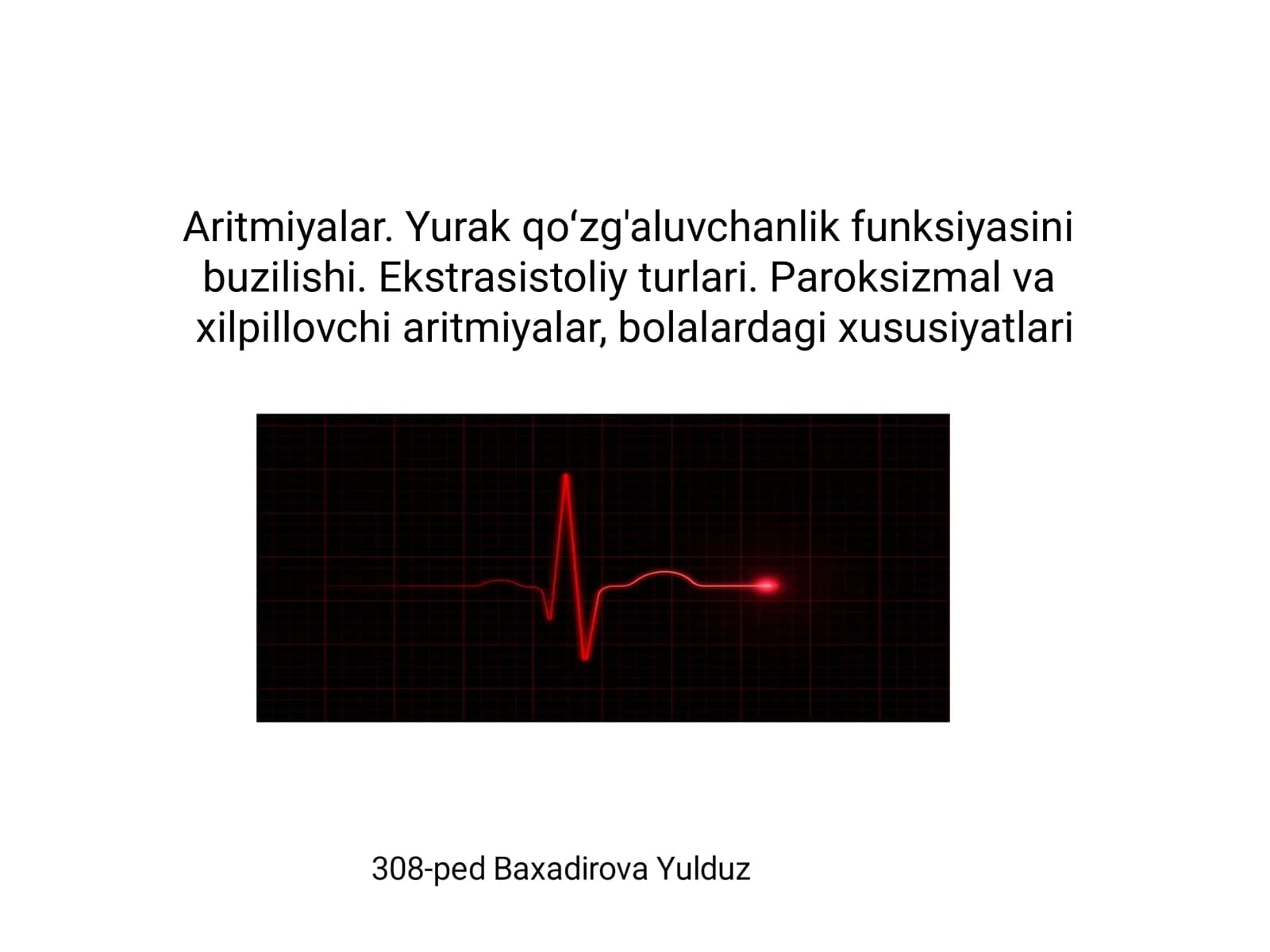 Aritmiyalar. Yurak qoʻzg'aluvchanlik funksiyasini buzilishi. Ekstrasistoliy turlari. Paroksizmal va xilpillovchi aritmiyalar, bolalardagi xususiyatlari