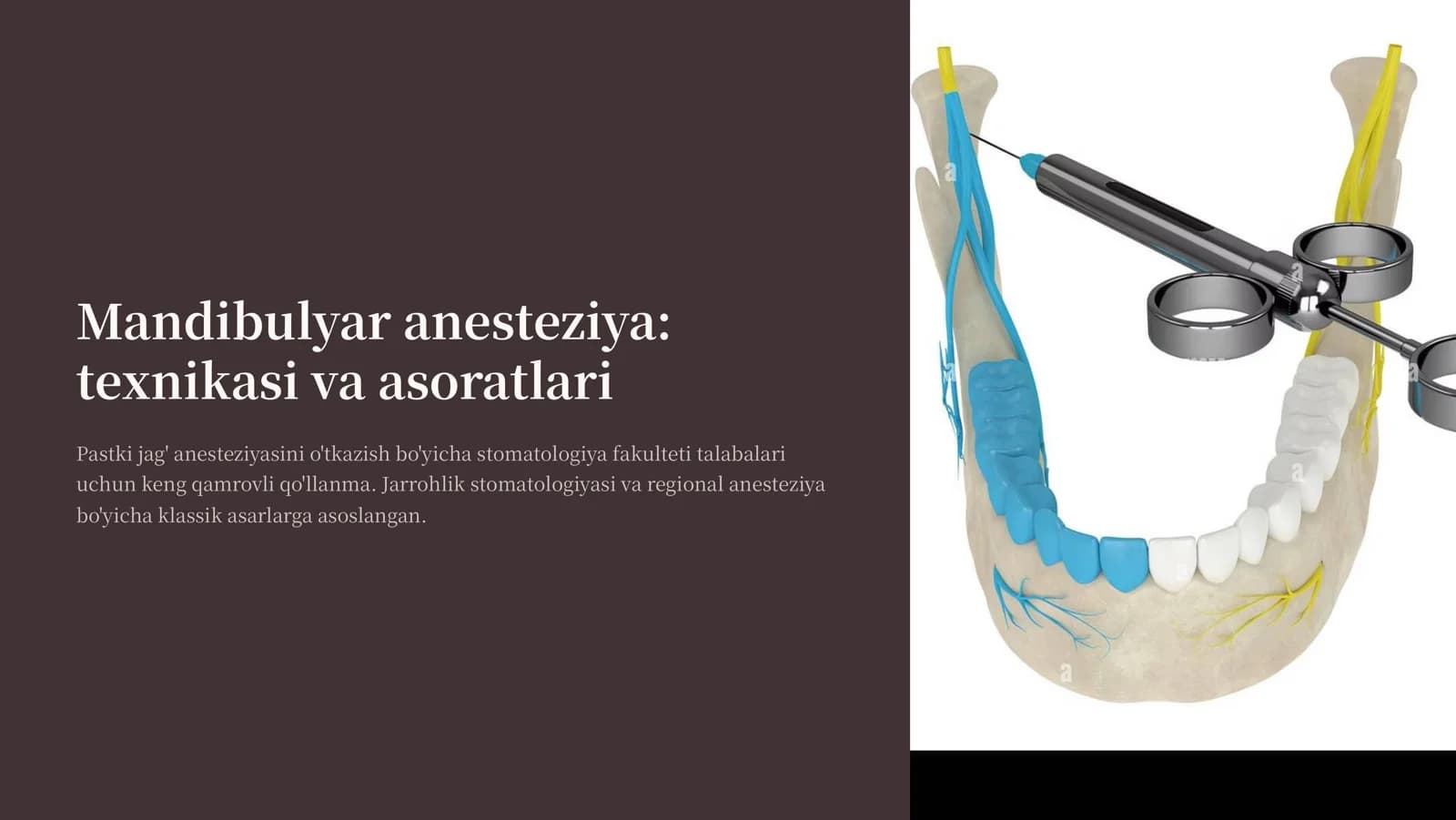 Mandibulyar anesteziya