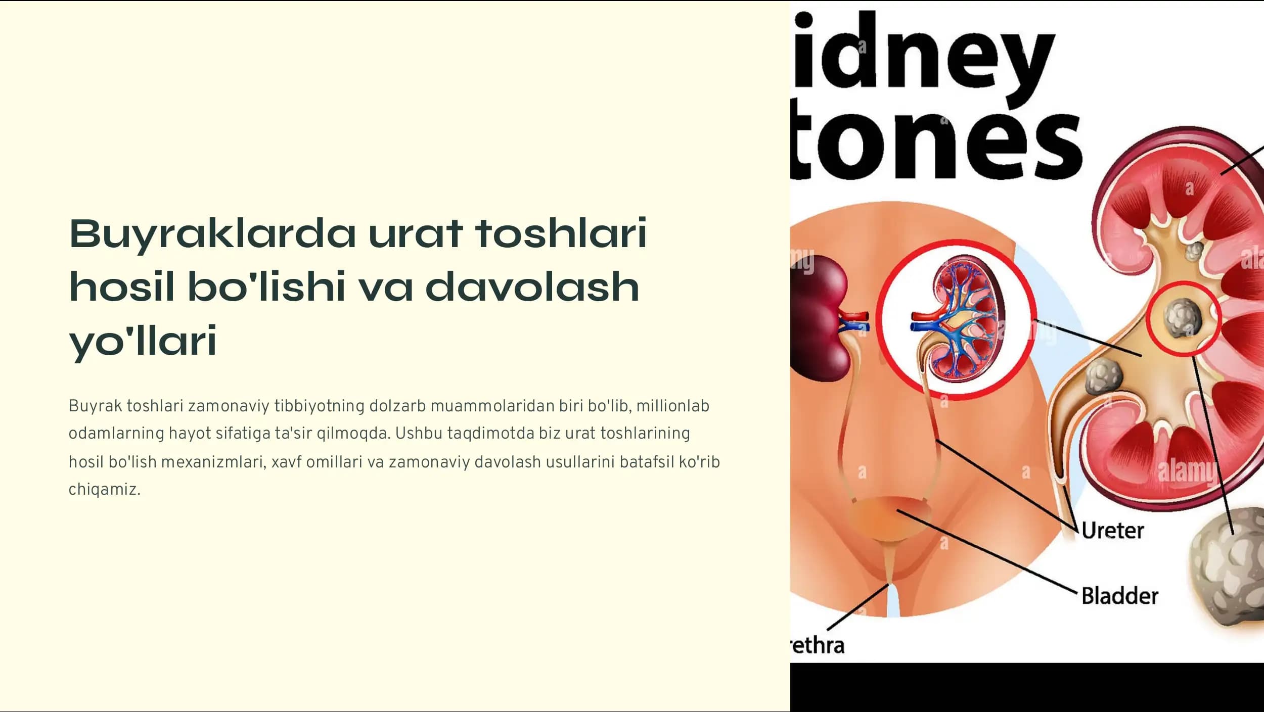 Urat toshlari