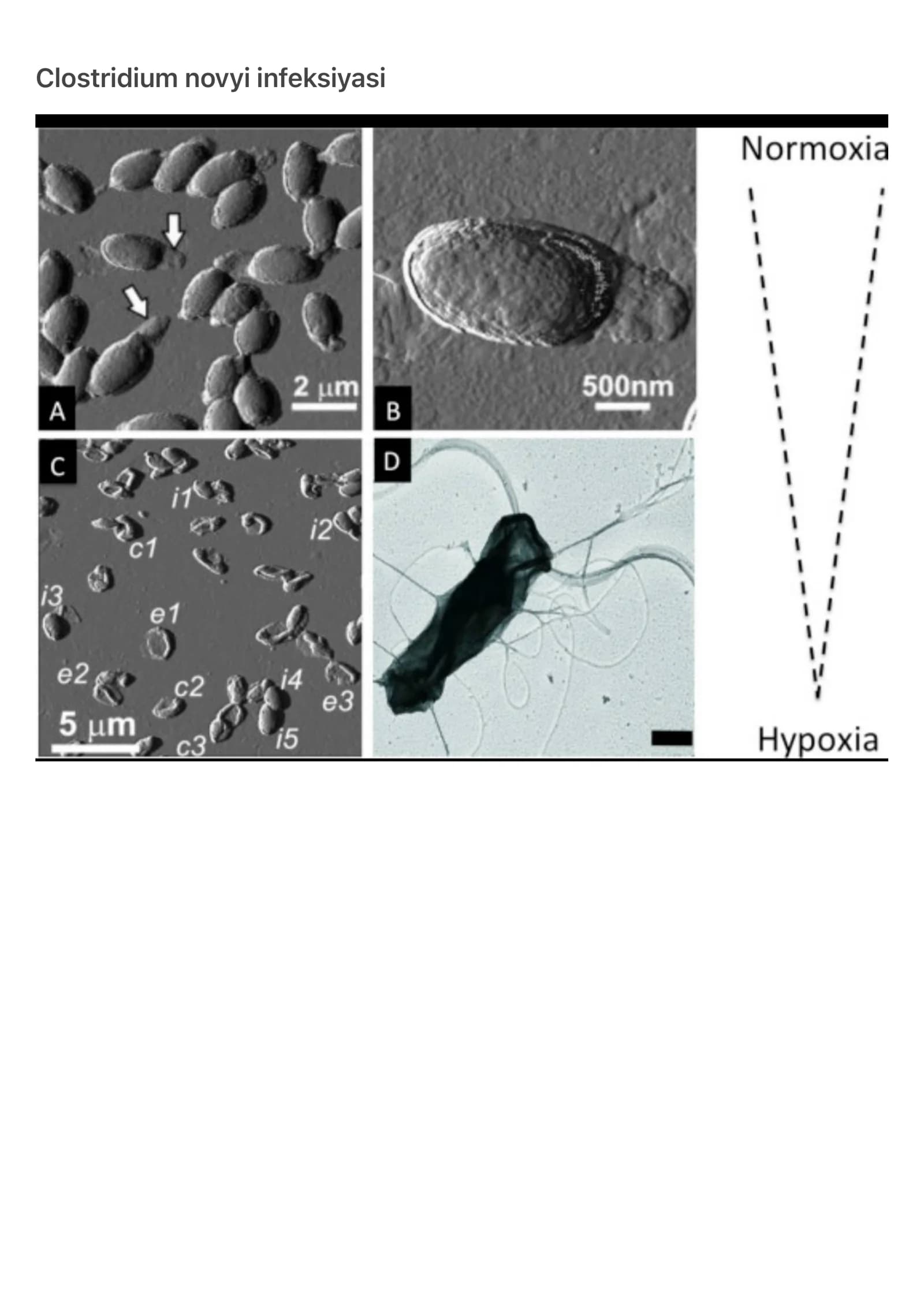 Clostridium novyi infeksiyasi