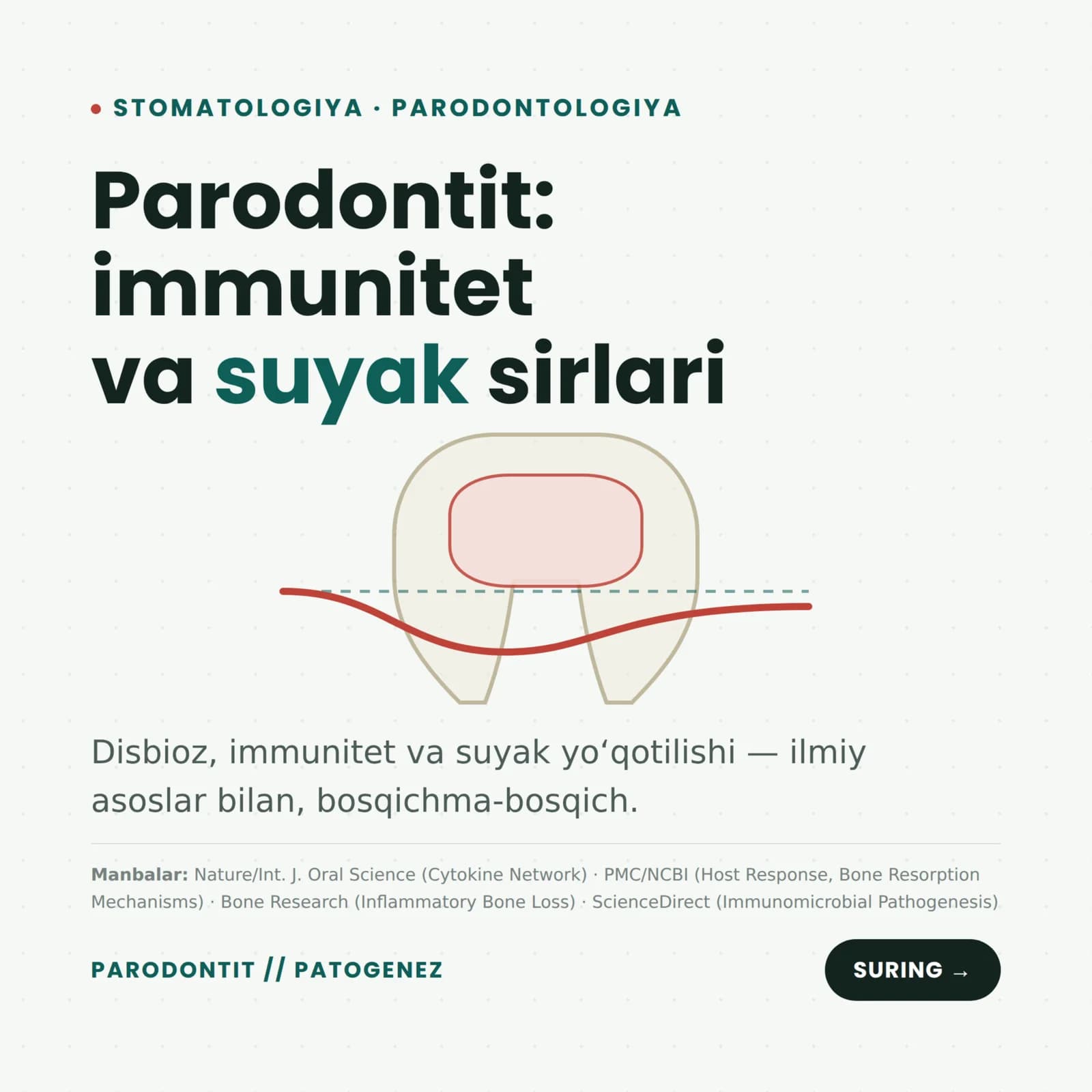 Parodontit nima va uning patalogiyasi