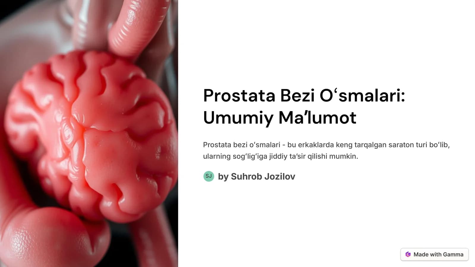 Prostata Bezi Oʻsmalari