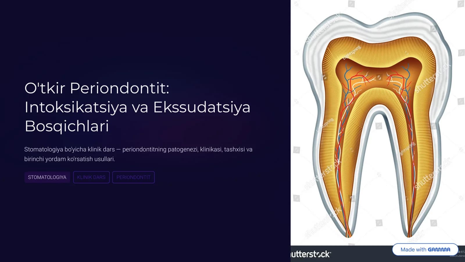 Otkir periodontit