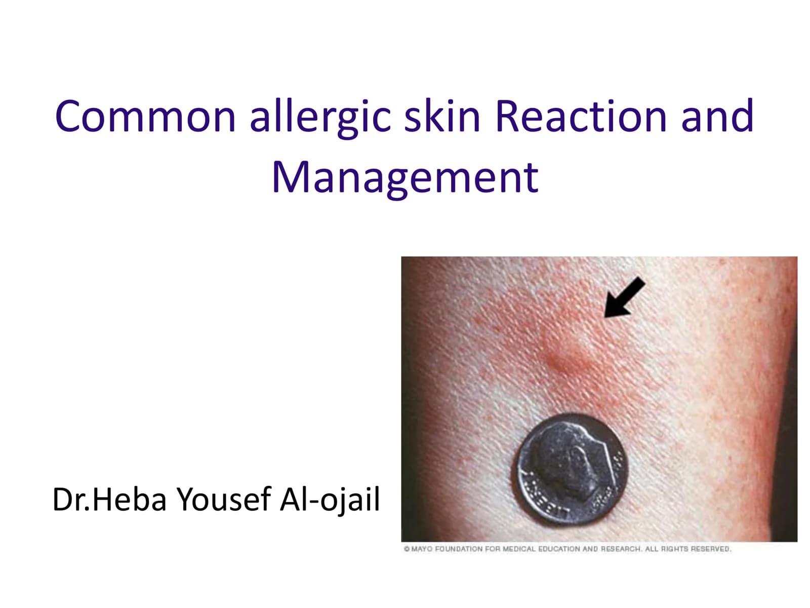 Common allergic skin Reaction and Management