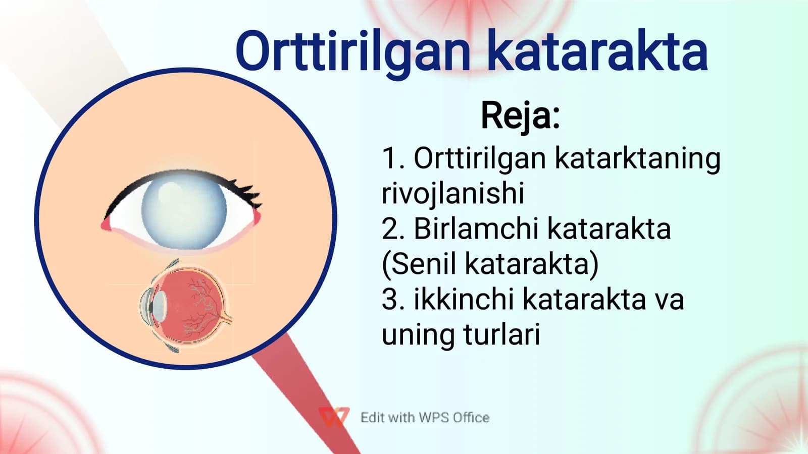 Orttirilgan katarakta
