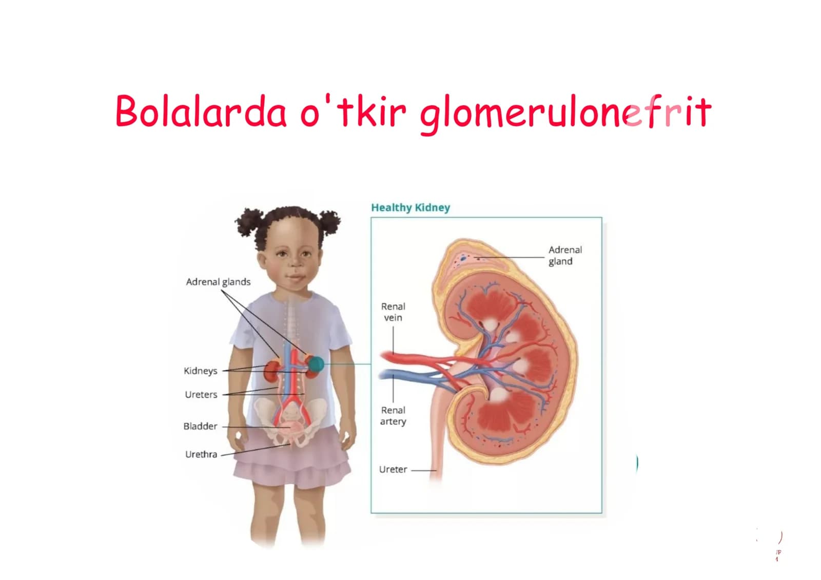 Glomerulonefrit toliq 25 list ppt