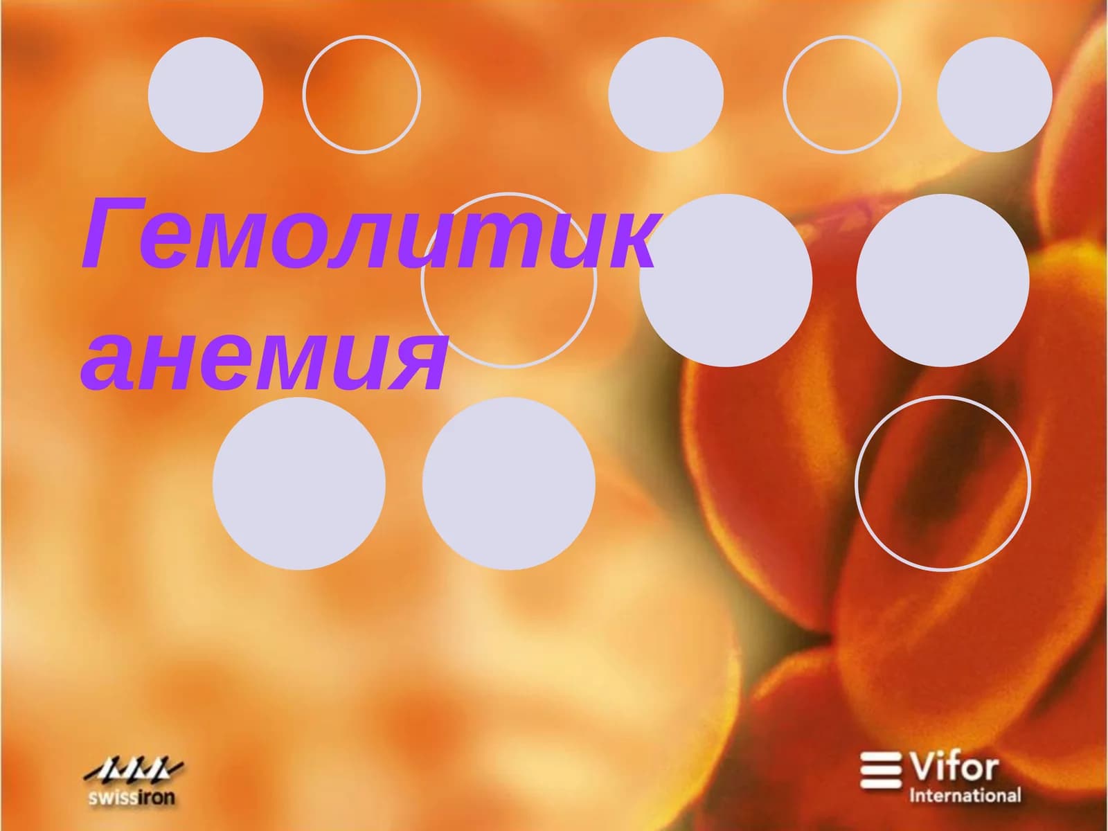 Гемолитик анемия