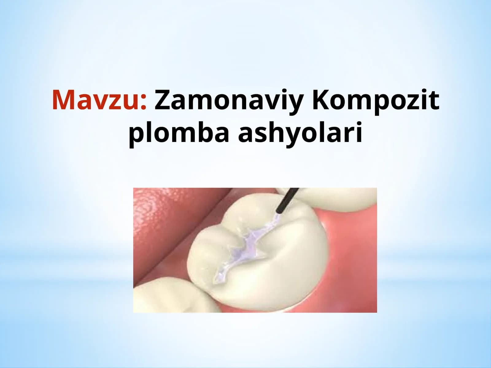 Zamonaviy Kompozit plomba ashyolari