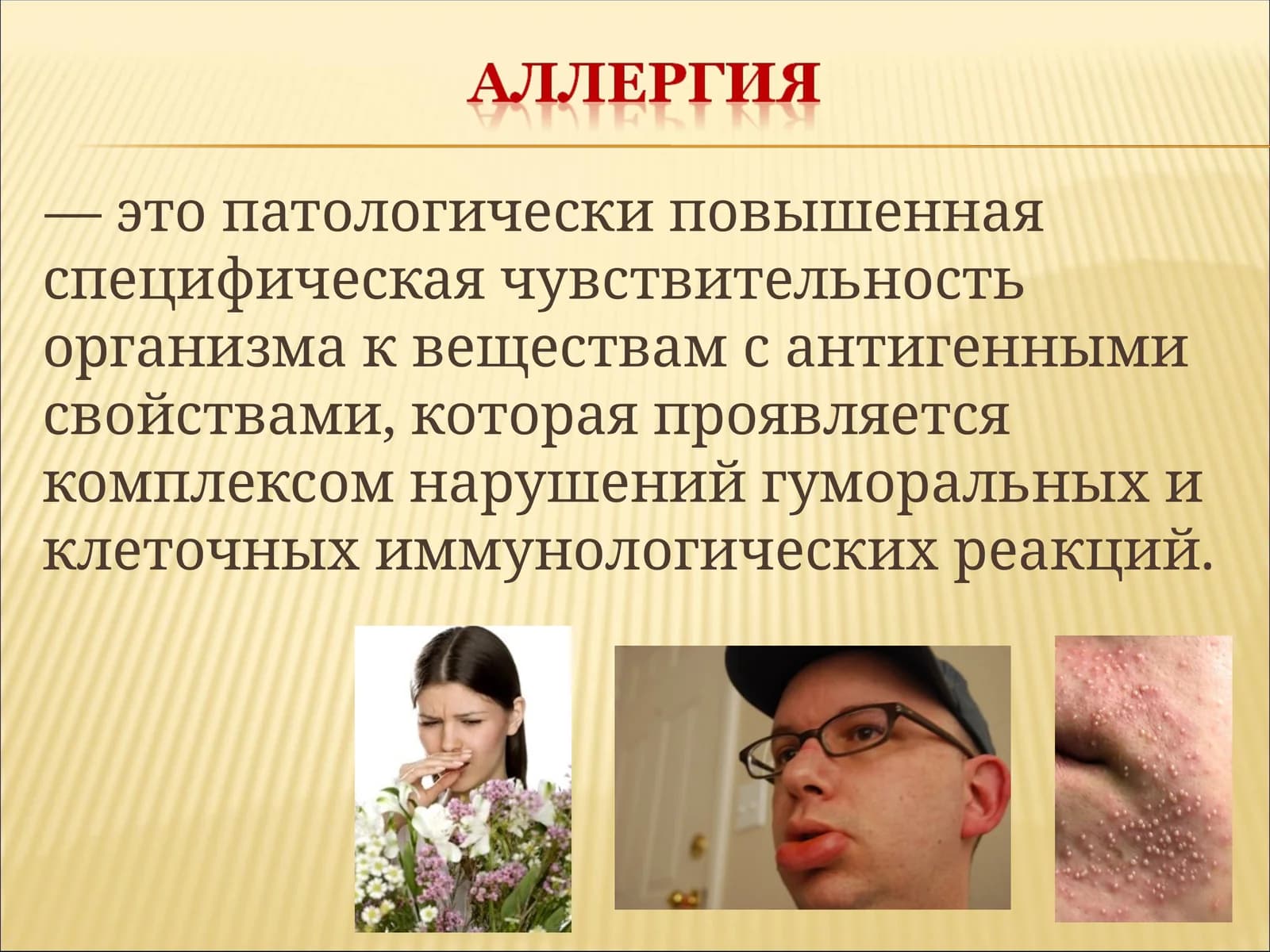 Аллергия