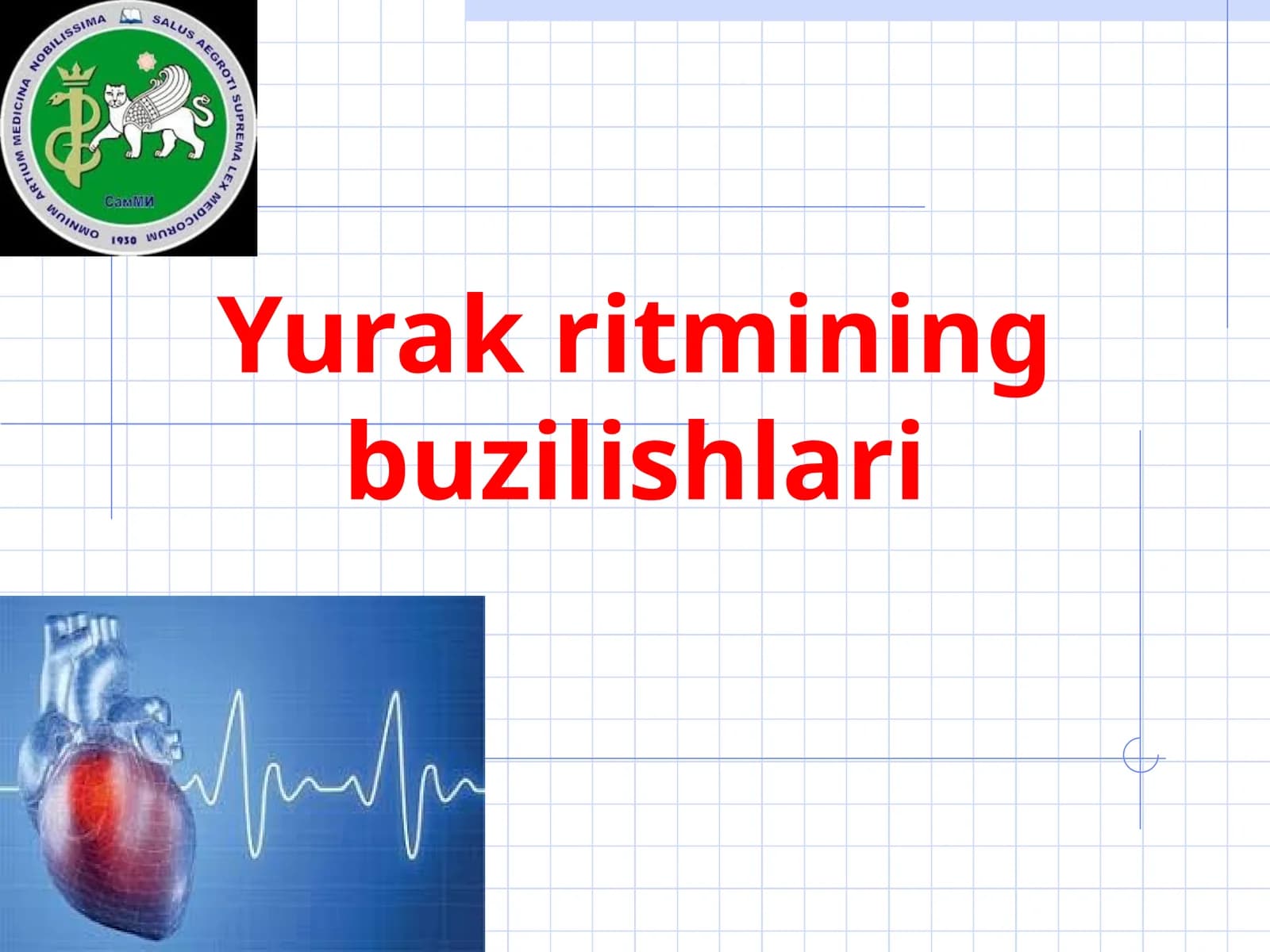 Yurak ritmining buzilishlari