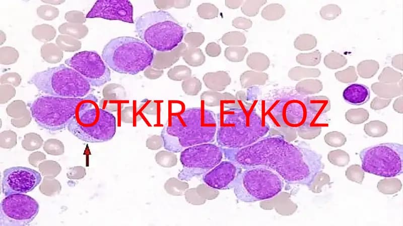 O’TKIR LEYKOZ