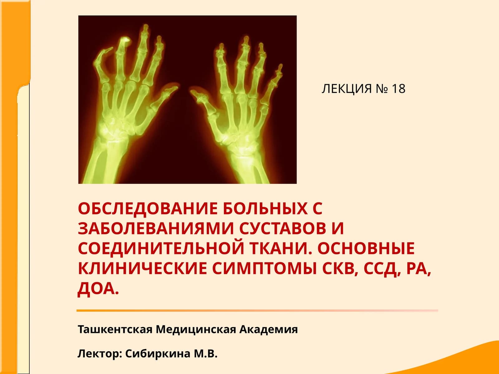 Диффузные заболевания соединительной ткани