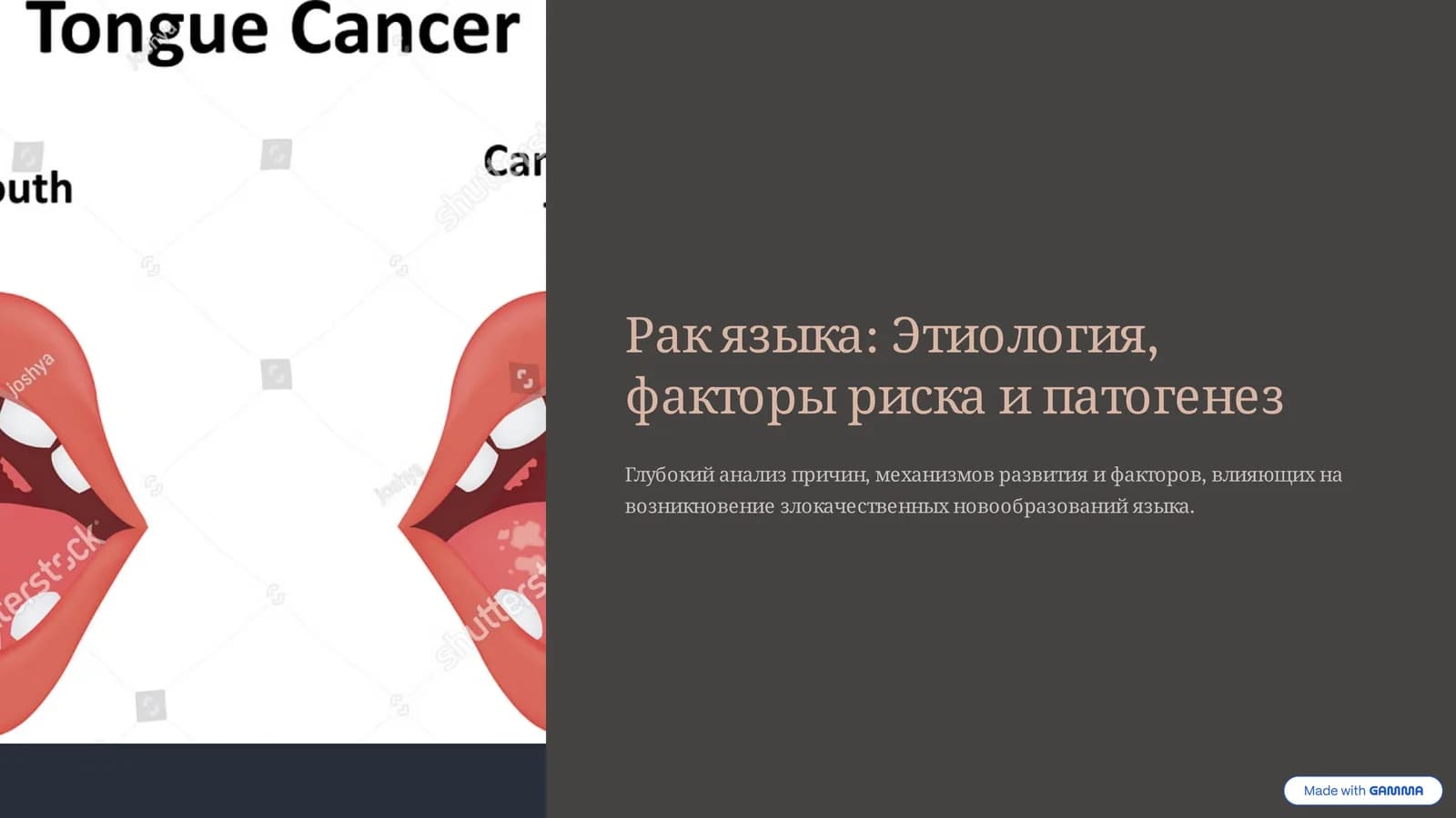 Рак языка: Etiologiya, faktory riska i patogenez