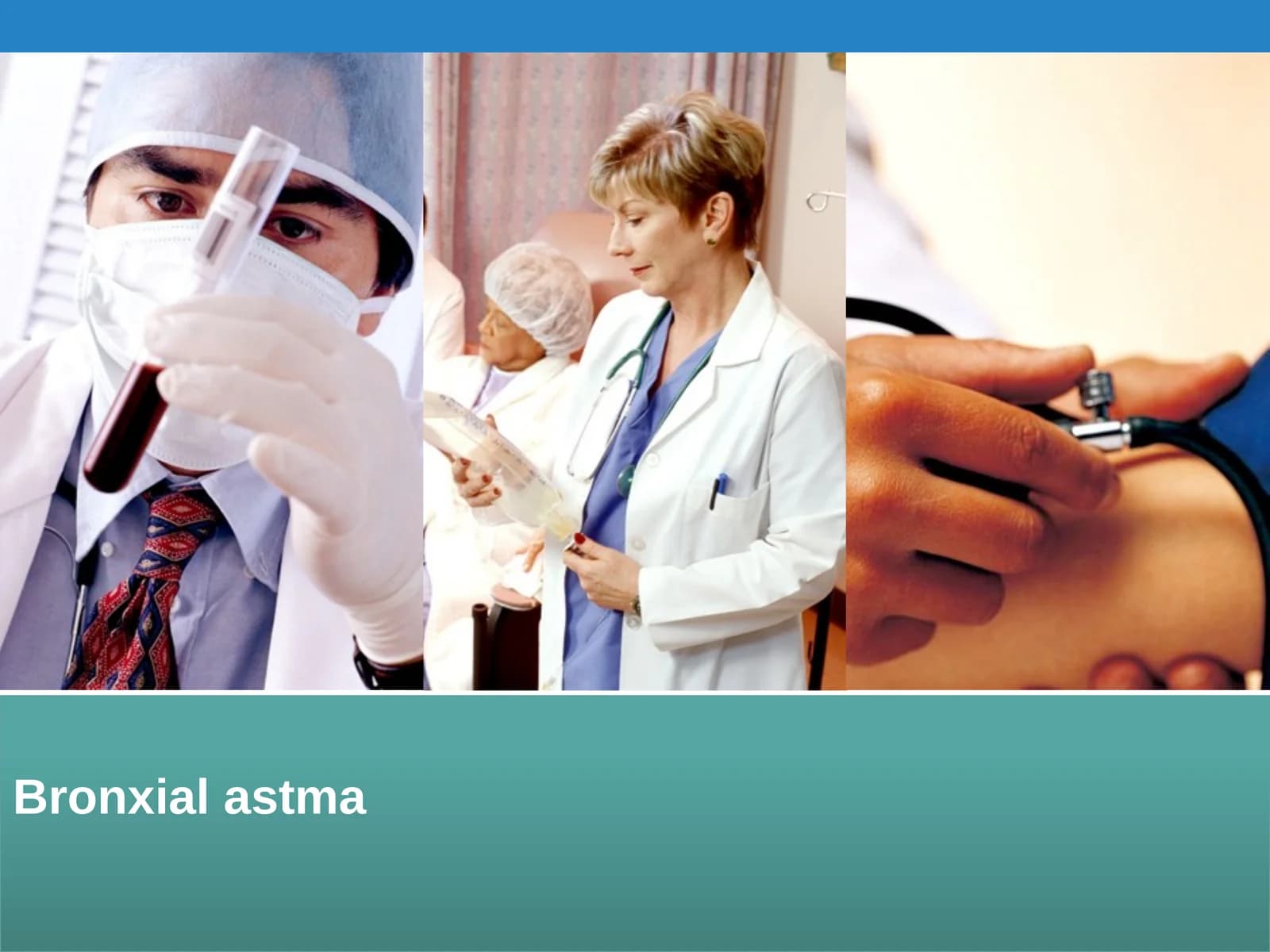 Bronxialastma