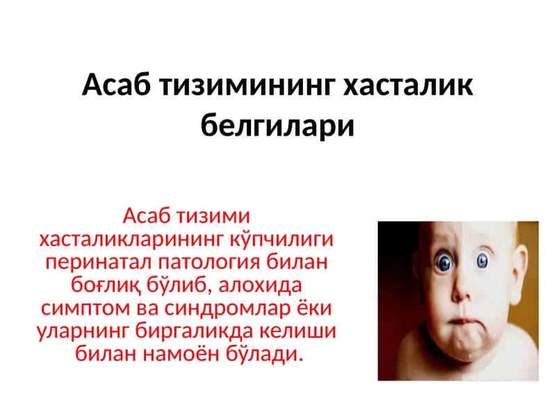 Кам қўзғалувчанлик синдроми