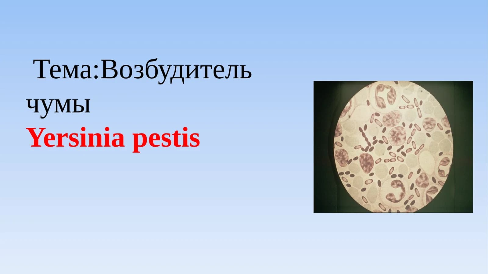 Тема:Возбудитель чумы