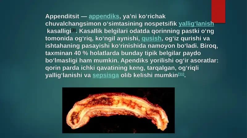 Appenditsit
