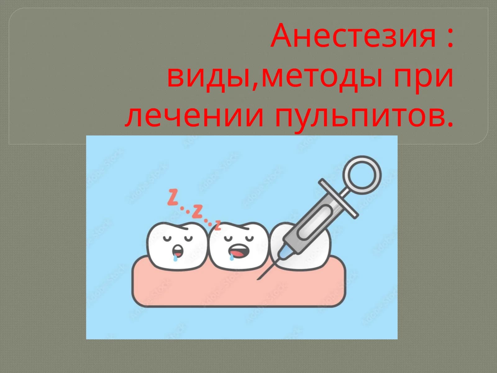 Анестезия: виды, методы при лечении пульпитов