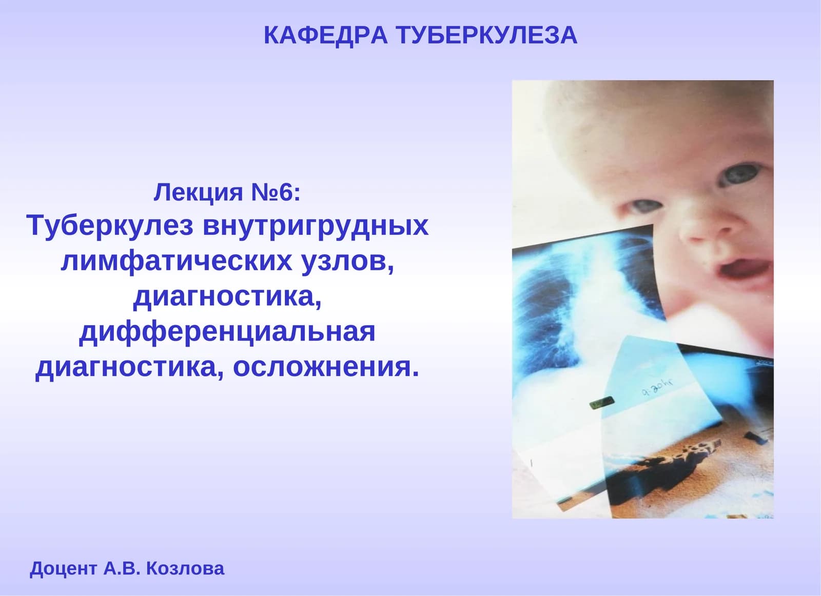 Лекция №6: Туберкулез внутригрудных лимфатических узлов