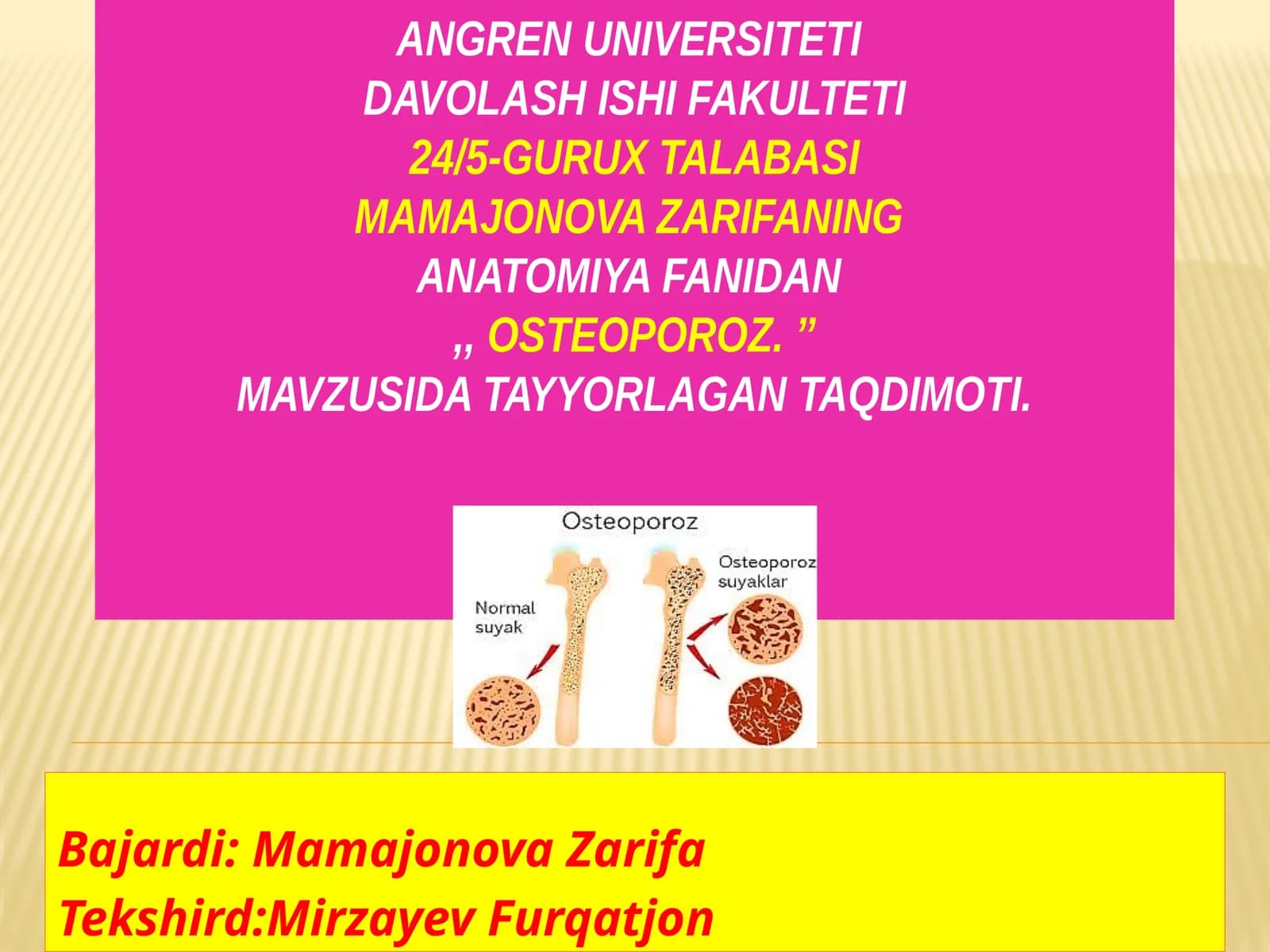 Osteoporoz