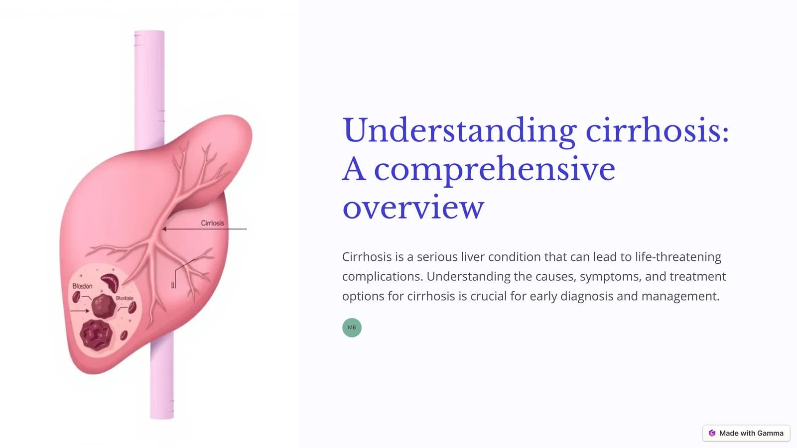 Understanding cirrhosis: A comprehensive overview