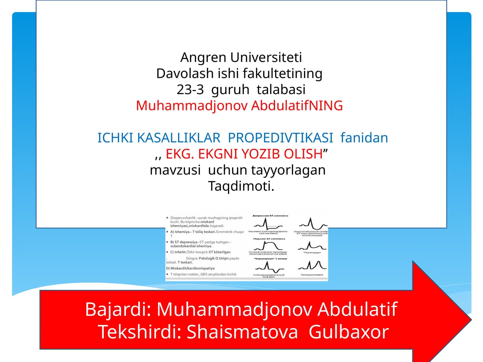 EKG. EKGNI YOZIBOLISH