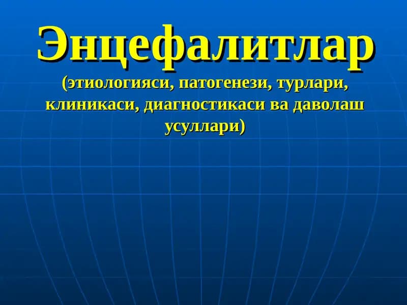 Энцефалитлар