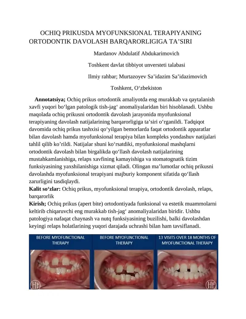 OCHIQ PRIKUSDA MYOFUNKSIONAL TERAPIYANING ORTODONTIK DAVOLASH BARQARORLIGIGA TA’SIRI