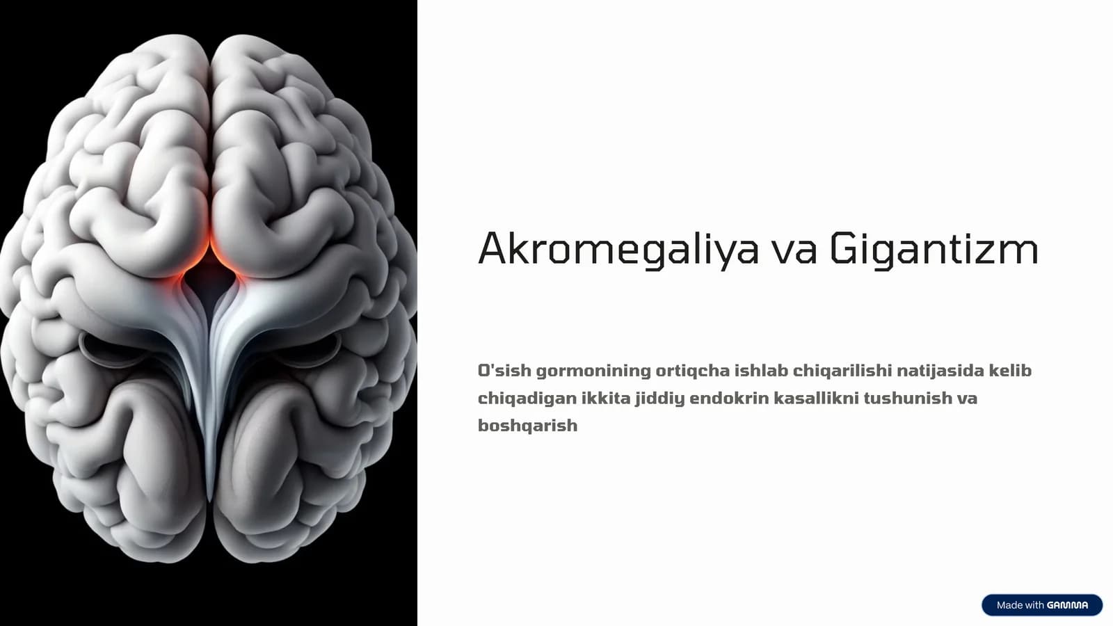 Akromegaliya va Gigantizm