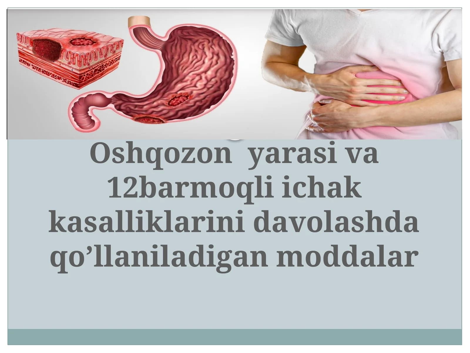Oshqozon  yarasi va 12barmoqli ichak kasalliklarini davolashda qo’llaniladigan moddalarr