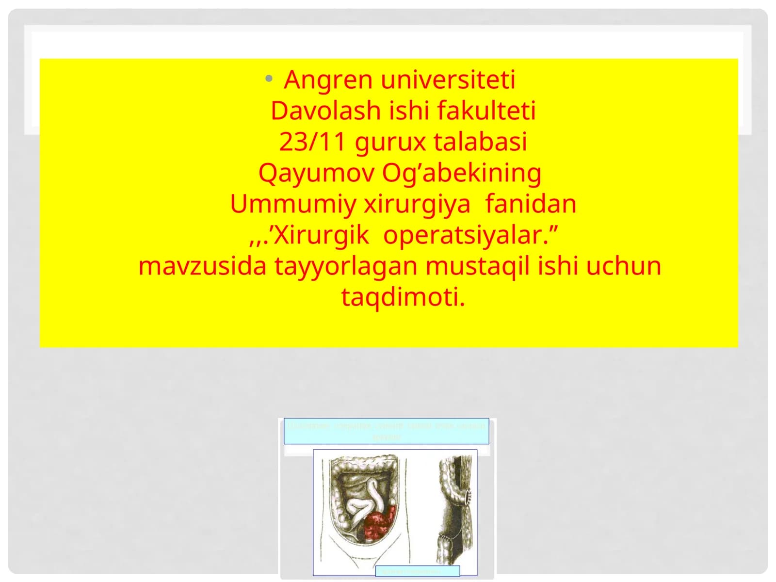 Xirurgik operatsiyalar