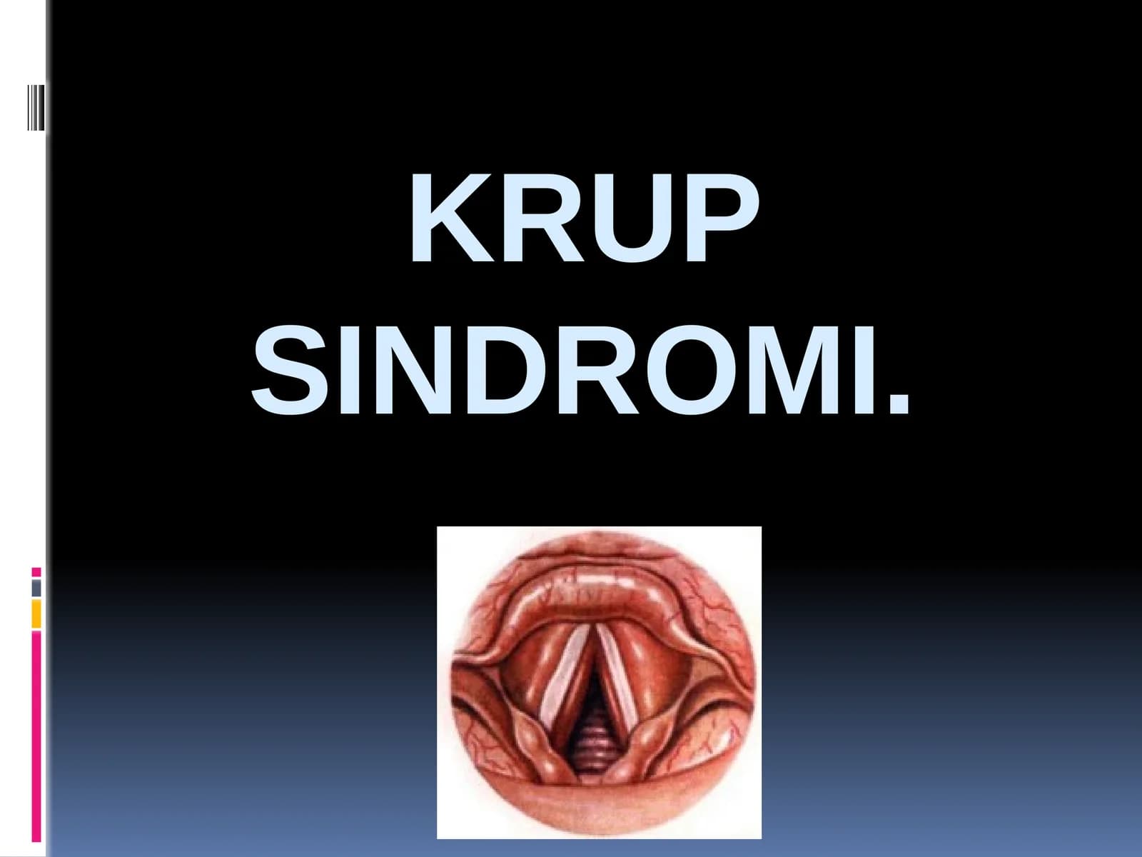 Krup sindromi
